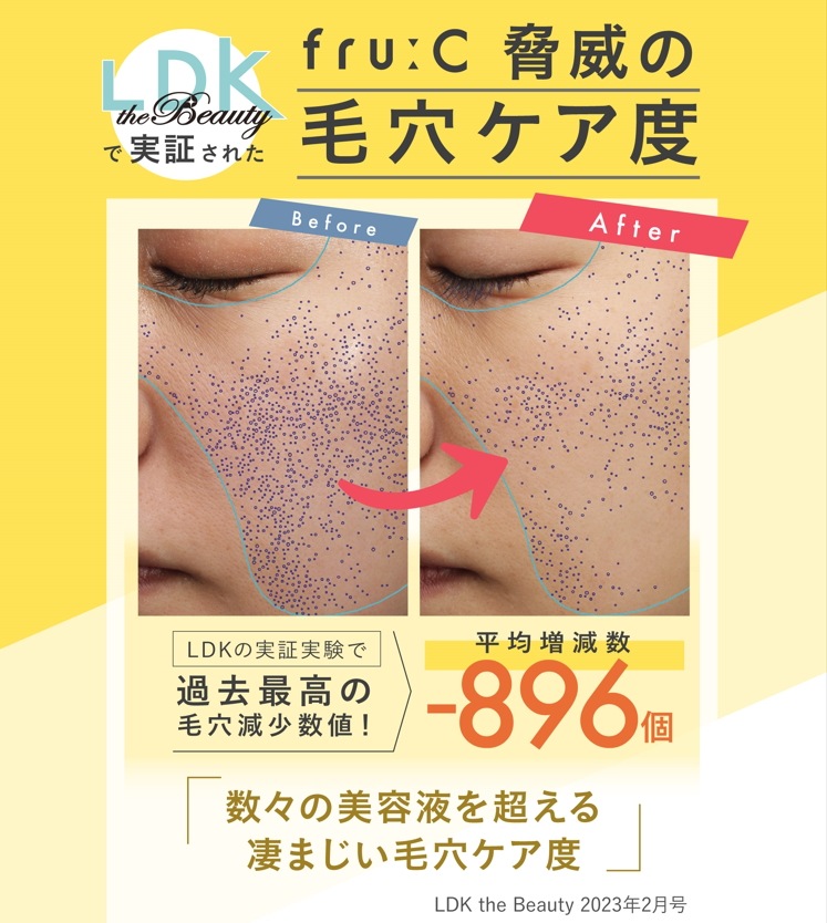 【毛穴ケア1位】2本セット! フルーシ―高濃度ビタミンC美容液 オールインワン / 毛穴ケア / ビタミンC誘導体 / トーンアップ / くすみ / 無添加 【毛穴ケア1位】2本セット! フルーシ―高濃度ビタミンC美容液 オールインワン / 毛穴ケア / ビタミンC誘導体 / トーンアップ / くすみ / 無添加