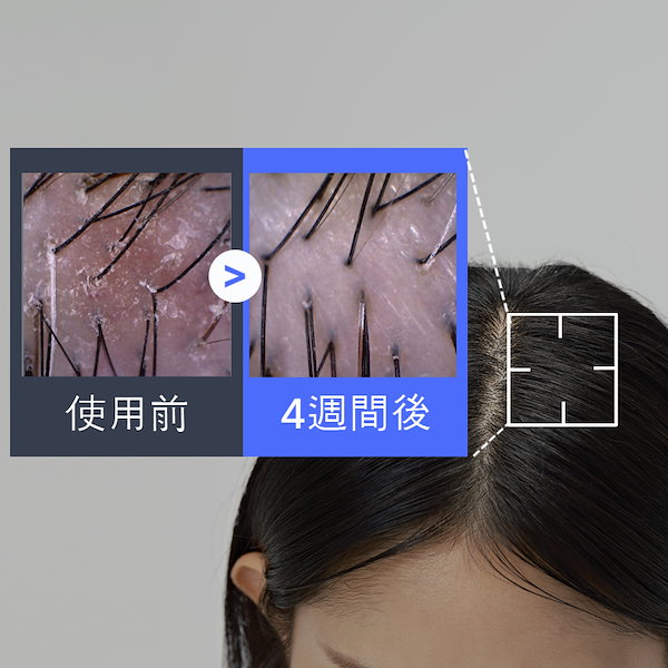 ANDKWAN スカルプロート カーム＆バリア × 櫛一体型＋詰め替えセット Qoo10] ANDKWAN スカルプロート カーム＆バリア × 櫛一
