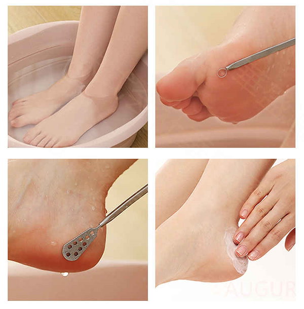 Qoo10] 魚の目削り タコ ピンポイントスムーサー