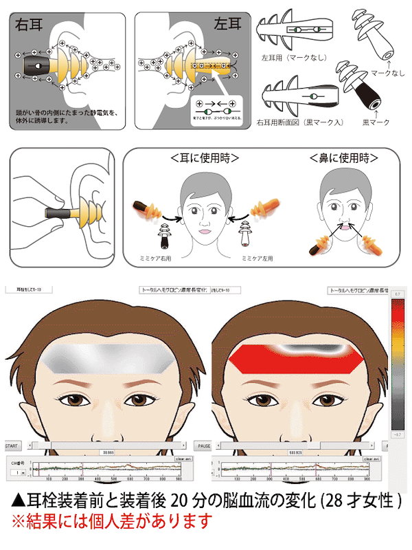 除電耳栓 ミミケア(耳鼻兼用) - 製造、工場用