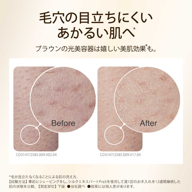 ブラウン　BRAUN　家庭用光美容器「シルクエキスパートPro5」(IPL方式/VIO対応/サロン同様のテクノロジー/女性・男性用) BRAUN ホワイト＆ゴールド　PL5248