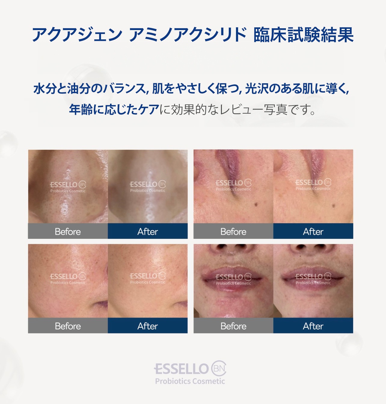 乾燥・敏感ケアの決定版 乾燥肌 赤みケア 敏感肌 アクアゲンアミノシングルキット保湿 角質ケア 乾燥肌 スキンケア 美容液 保湿 しわ改善クリーム 肌バリア 乳酸菌 プロテインアンプル essello 乾燥・敏感ケアの決定版 乾燥肌 赤みケア 敏感肌 アクアゲンアミノシングルキット保湿 角質ケア 乾燥肌 スキンケア 美容液 保湿 しわ改善クリーム 肌バリア 乳酸菌 プロテインアンプル essello