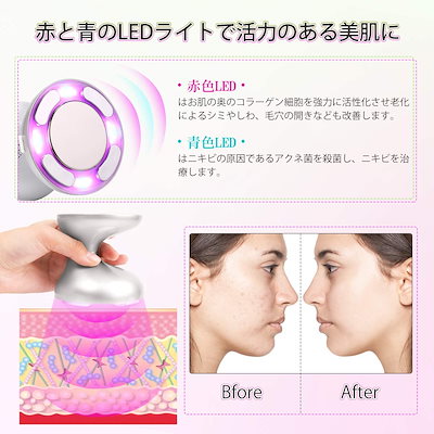 Qoo10] キャビテーション 家庭用 超音波美顔器 : 美容・健康家電