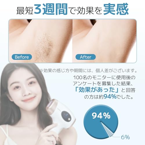 Sarlisi 脱毛器 無痛脱毛 自動照射 60万発9段階 全身適用 VIO対応 家庭用 男女兼用 ipl 光脱毛器 髭 だつもうき脱毛器 メンズ サーリシ White Ai01