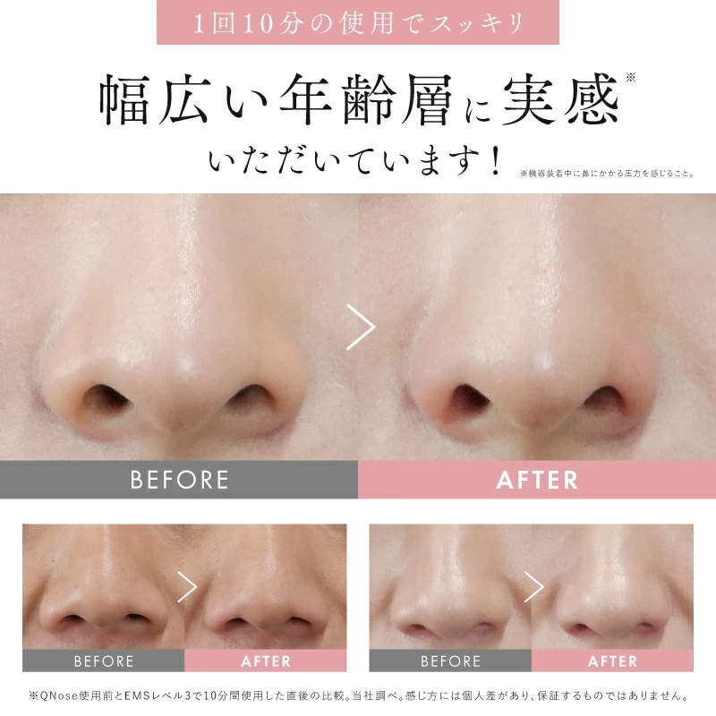 Qoo10] ニップラックス NIPLUX 鼻専用美顔器 QNose