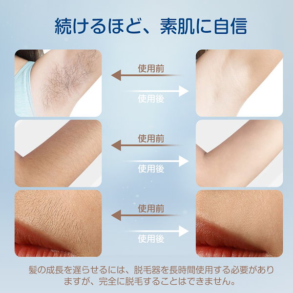 Qoo10] 脱毛器 IPL光脱毛器 家庭用 全身ケア