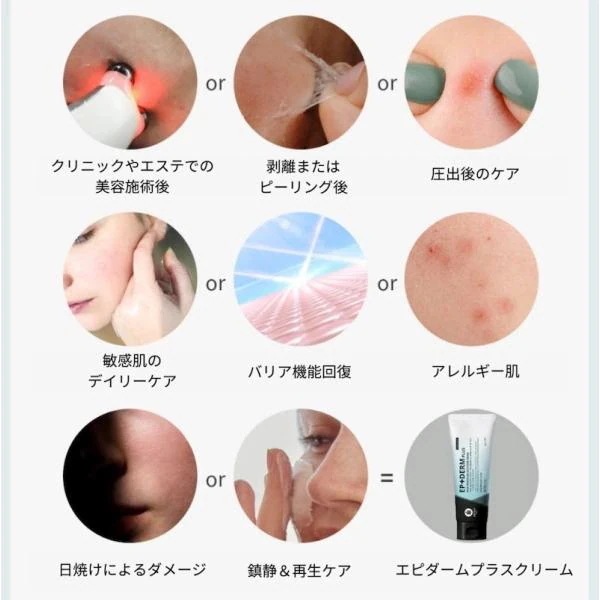 【国内正規品】 EPIDERM PLUS エピダームプラスクリーム 100g RIBESKIN フェイスクリーム カーボキシー炭酸パック エピダーム プラス 保湿 乾燥 美容 コスメ スキンケア