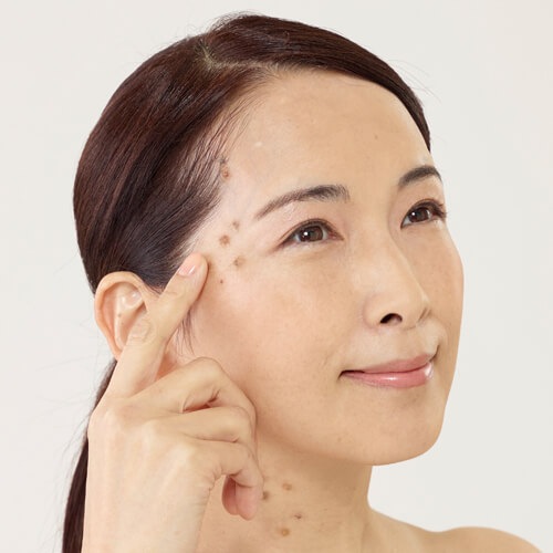 イポロン G 150g 3本セット イポロン G 150g 3本セット