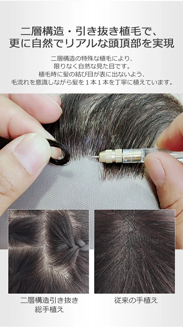 私元気 人毛 部分ウィッグ BHADS812-25 (送料無料) ポイントウィッグ 白髪かくし つけ毛 トップカバー 女性 レディース つむじ付き レミーヘアー レミーヘア 自然 ナチュラル 私元気 人毛 部分ウィッグ BHADS812-25 (送料無料) ポイントウィッグ 白髪かくし つけ毛 トップカバー 女性 レディース つむじ付き レミーヘアー レミーヘア 自然 ナチュラル