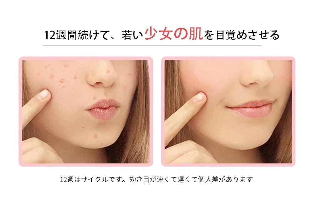 【自宅で美容】小型 多機能美顔器 シワ対策 肌引き締め 4段波 韓国RF造顔技術 EMS微電流 4色LED美肌 音波振動 イオン導入 毛穴ケア ミニ スキンケア コスメ コスメティック メガ割 母の日 【自宅で美容】小型 多機能美顔器 シワ対策 肌引き締め 4段波 韓国RF造顔技術 EMS微電流 4色LED美肌 音波振動 イオン導入 毛穴ケア ミニ スキンケア コスメ コスメティック メガ割 母の日