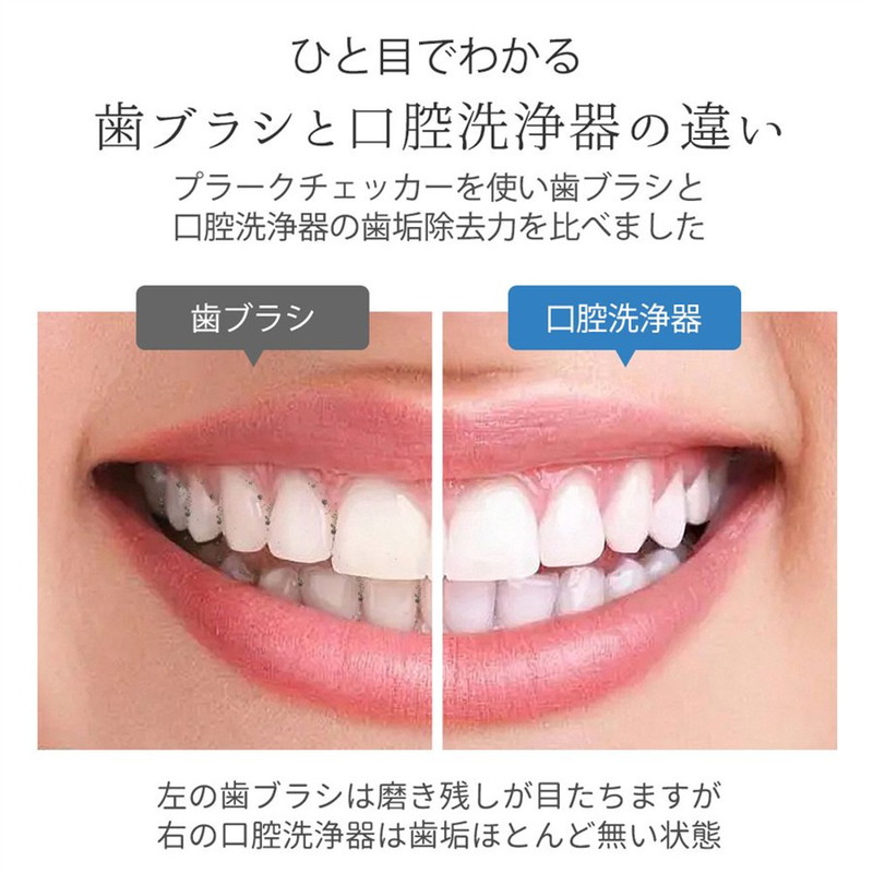 口腔洗浄器 ウォーターフロス 口腔洗浄機 ジェットウォッシャー 口腔ケア 300ml大容量タンク 歯ブラシ 防水 USB充電式 5本ノズル 口腔洗浄器 ウォーターフロス 口腔洗浄機 ジェットウォッシャー 口腔ケア 300ml大容量タンク 歯ブラシ 防水 USB充電式 5本ノズル