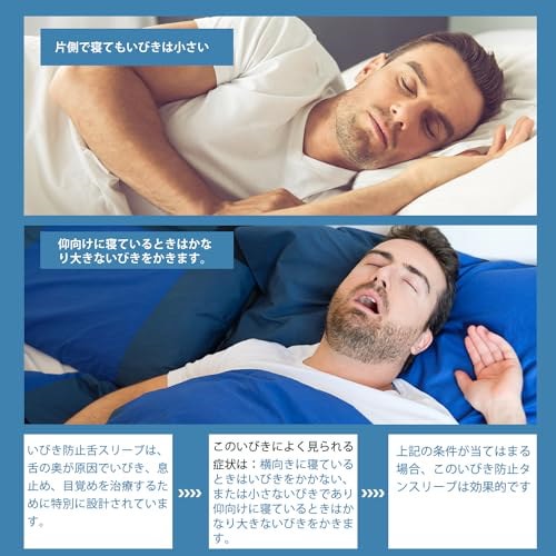 舌用マウスピース いびき防止グッズ 安眠 無呼吸症候群 暑苦し 水洗い可能 売買されたオークション情報 落札价格 【au  payマーケット】の商品情報をアーカイブ公開