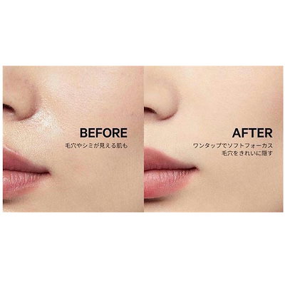 Qoo10] マイクロニードル エクソソーム クッショ : ベースメイク