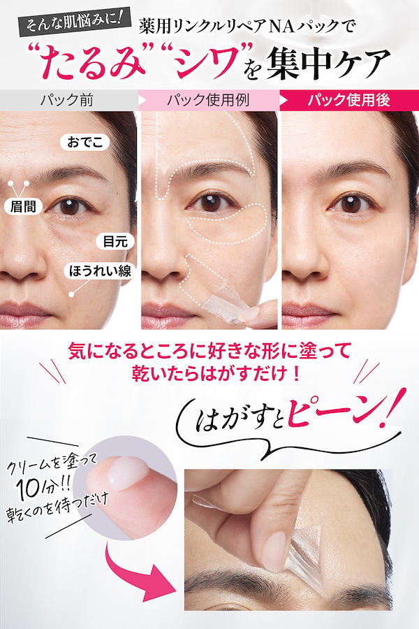 Qoo10] cosmejitan 薬用 シワ 改善クリーム レチノール ナ