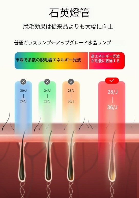 【期間限定クーポン配布】 氷点無痛脱毛器氷点快適脱毛唇脇腕太ももビキニ使用可能脱毛機器