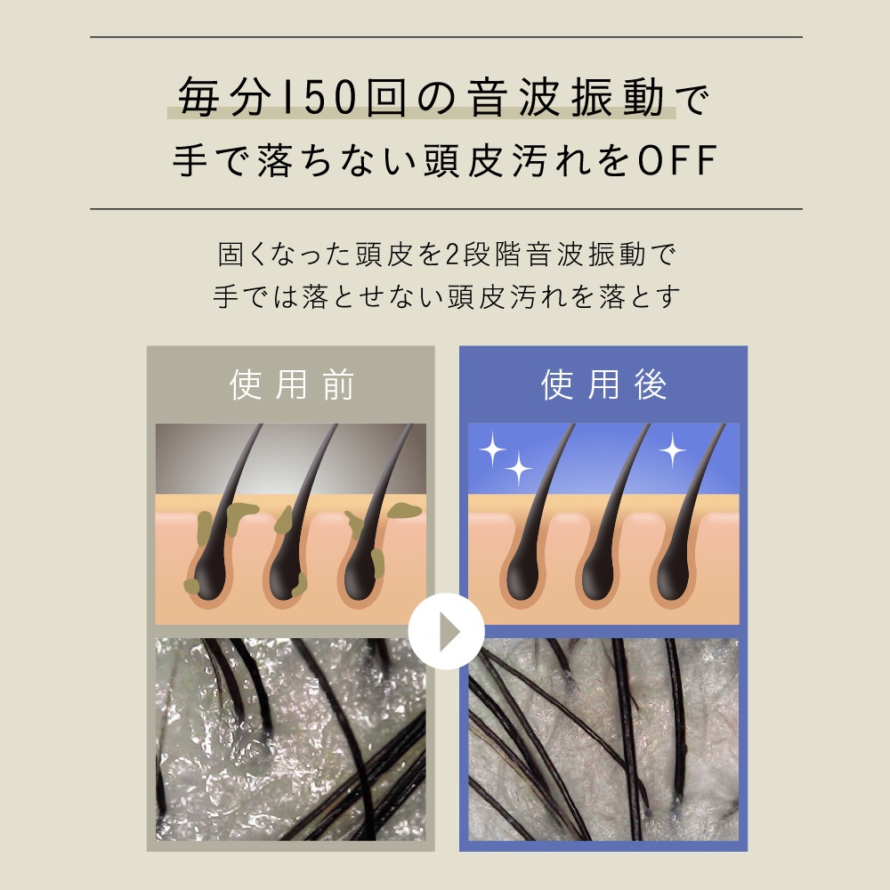 【MONOQLOベストバイ受賞】自宅で本格ヘッドスパ！Noend リフトヘッドスパ ヘッドマッサージャー リフトアップ 小顔 頭皮ケア 軽量226g 完全防水 エイジングケア ほうれい線 しわ たるみ