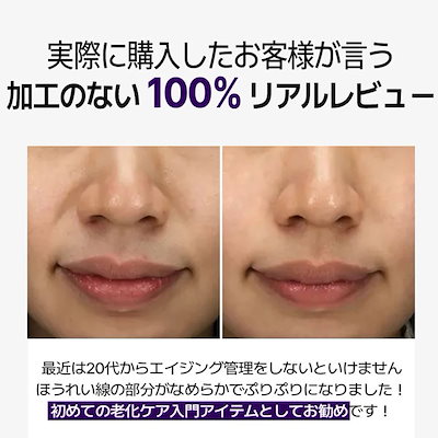 DIFFER&DEEPER ビトック 3ml×10個 B-TOX FOR DAILY RX 3ml *10ea ディーパーアンドディーパー