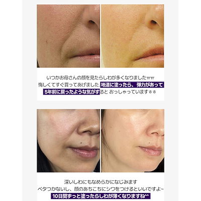 DIFFER&DEEPER ビトック 3ml×10個 B-TOX FOR DAILY RX 3ml *10ea ディーパーアンドディーパー