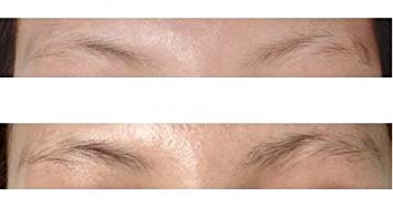 ブロウアディクト ブロウ　コンディショニング セラム 5ml （まゆ毛美容液） Blow addic