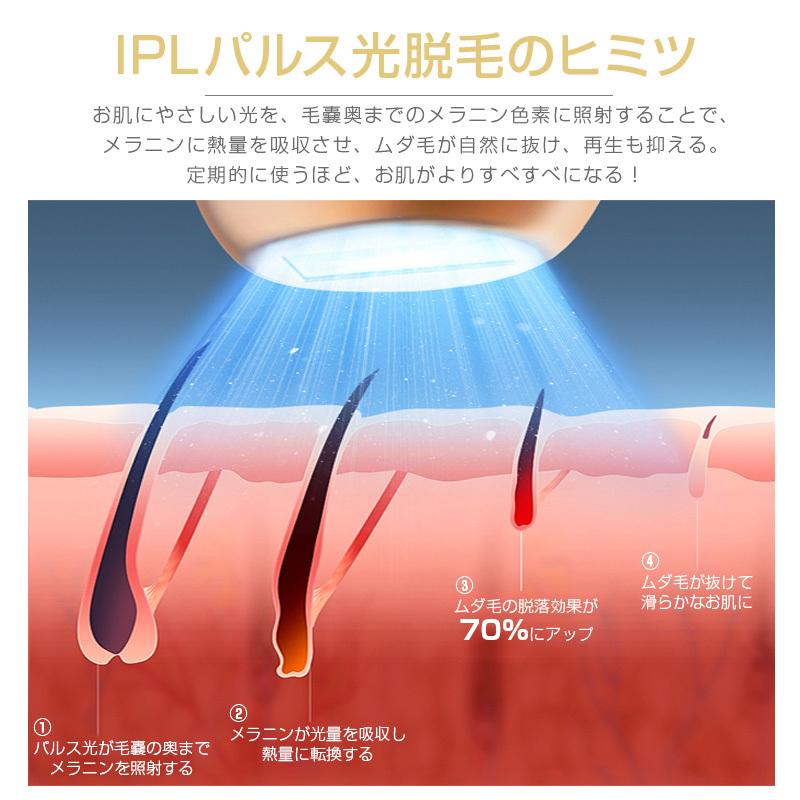 【2点購入で150OFF】【夏日限り激安SALE】脱毛器 IPL光脱毛 VIO対応 メンズ レディース 99万発照射回数 フラッシュ 家庭用 やすい サングラス 自動照射 全身 【2点購入で150OFF】【夏日限り激安SALE】脱毛器 IPL光脱毛 VIO対応 メンズ レディース 99万発照射回数 フラッシュ 家庭用 やすい サングラス 自動照射 全身