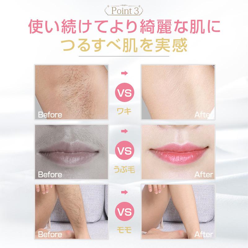 【2点購入で150OFF】【夏日限り激安SALE】脱毛器 IPL光脱毛 VIO対応 メンズ レディース 99万発照射回数 フラッシュ 家庭用 やすい サングラス 自動照射 全身 【2点購入で150OFF】【夏日限り激安SALE】脱毛器 IPL光脱毛 VIO対応 メンズ レディース 99万発照射回数 フラッシュ 家庭用 やすい サングラス 自動照射 全身