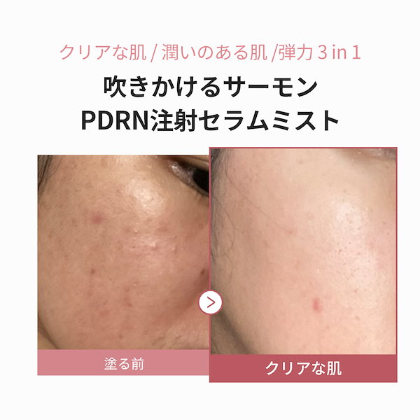 Qoo10] メディキューブ 【公式正品】 PDRN ピンクセラムミス