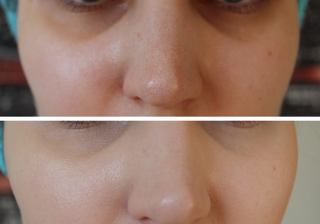 韓国コスメ 本体清浄連生 アンブレミッシュバーム二重機能性 BBクリーム フェイス ブレミッシュバーム 50ml SPF30 PA ++ 蓮の花エキス 水分と活力補充 すっぴんメークアップ 透明な 韓国コスメ 本体清浄連生 アンブレミッシュバーム二重機能性 BBクリーム フェイス ブレミッシュバーム 50ml SPF30 PA ++ 蓮の花エキス 水分と活力補充 すっぴんメークアップ 透明な