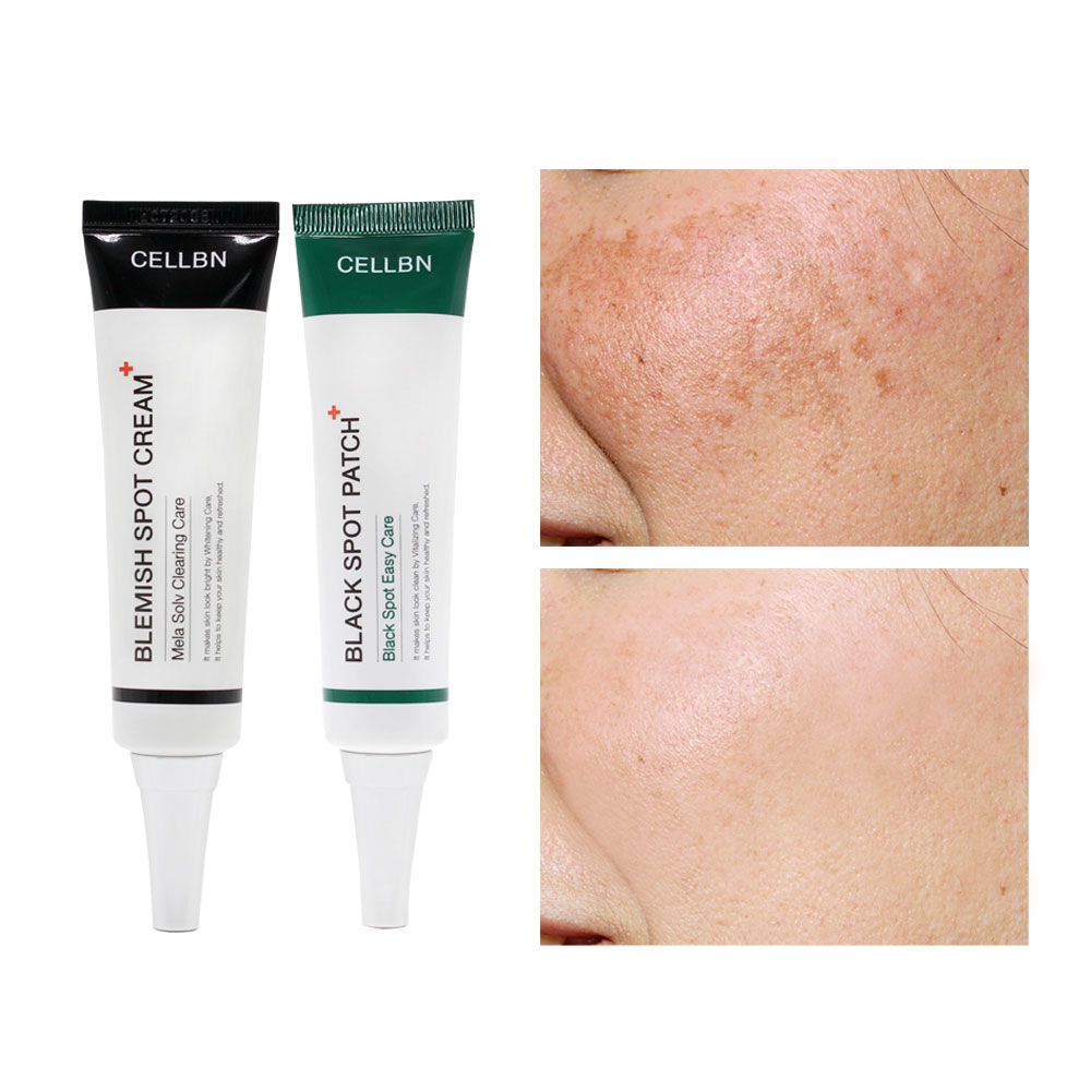 シミ取りクリーム+かさぶたパッチ30ml(set)/韓国コスメ/シミ&そばかすケア/ シミ取りクリーム+かさぶたパッチ30ml(set)/韓国コスメ/シミ&そばかすケア/