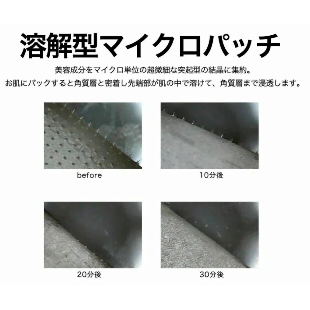 マイクロアイパッチ 2枚1回分 10枚セット フェイスマスク クリア ほうれい線 パック フェイスマスク ヒアルロン酸 針状 目元 口元 目の下 ヒアルロン酸 直注入 シート状美容液 韓国コスメ マイクロアイパッチ 2枚1回分 10枚セット フェイスマスク クリア ほうれい線 パック フェイスマスク ヒアルロン酸 針状 目元 口元 目の下 ヒアルロン酸 直注入 シート状美容液 韓国コスメ