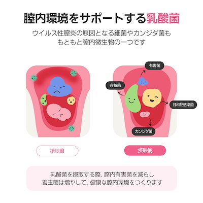 Qoo10] iHEAL [アイヒールヴィーナス] 韓国女性を輝か : 健康