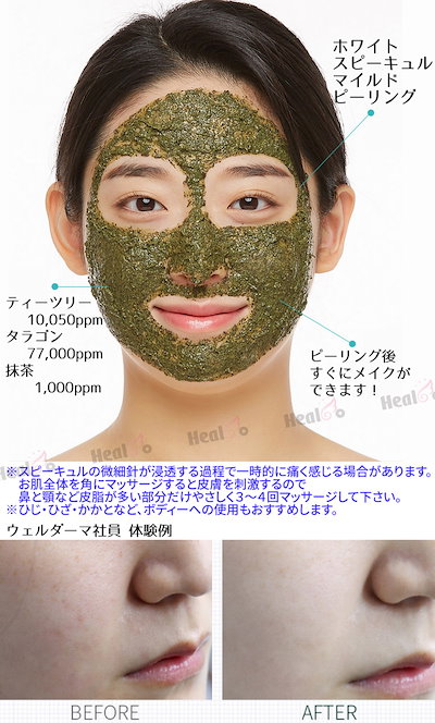 Qoo10] ウェルダーマ ハーブトックスピーリングパック150g : スキンケア