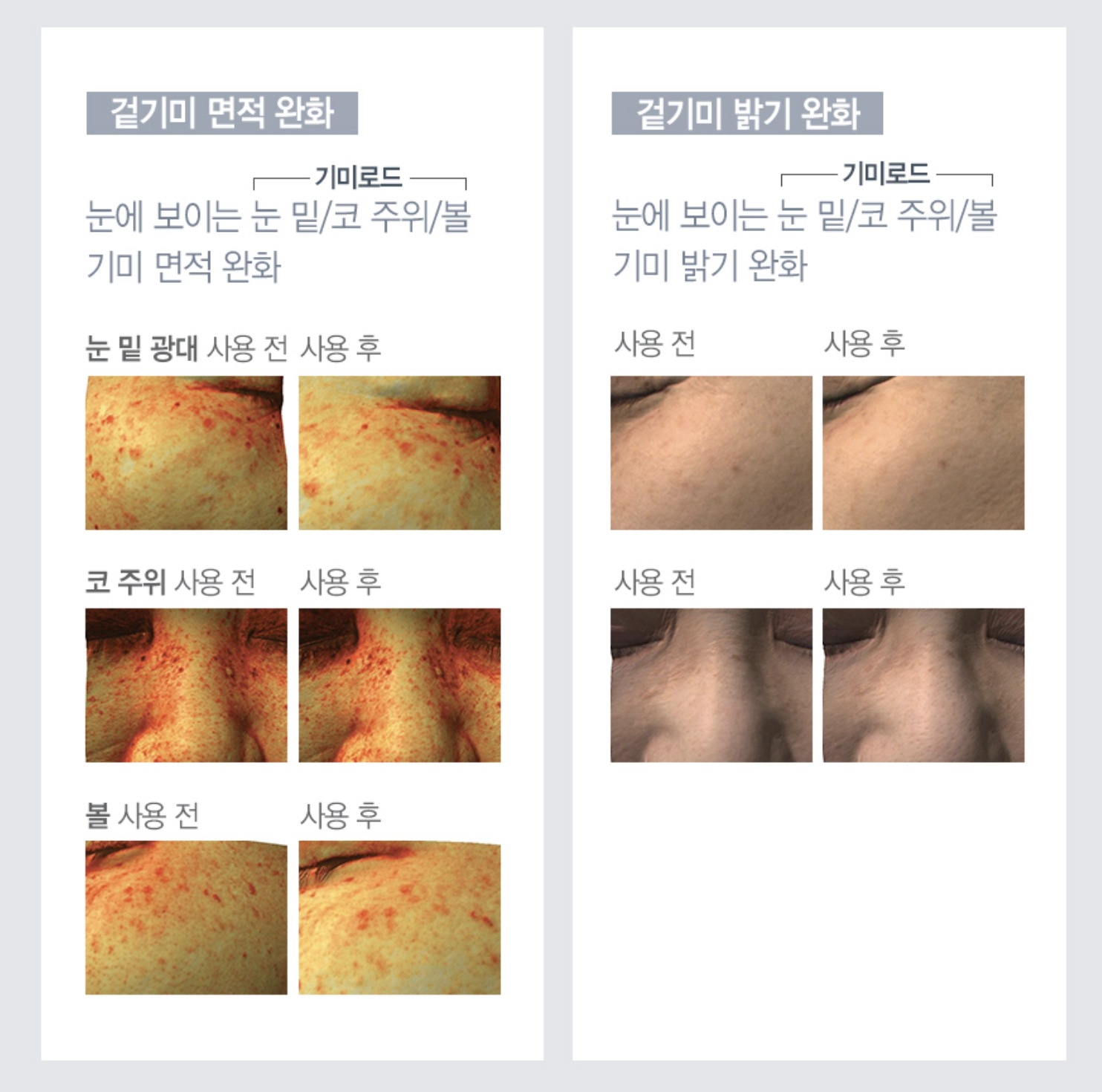 クスエイジフォーカス シミポオールクリーム