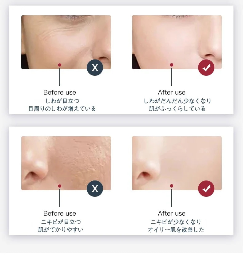 冷熱噴霧折りたたみ分光器LED光子赤青ニキビ除去皮膚器顔ナノ噴霧補水美容院 7色光PDT 家庭用 LED美顔器 加湿器スプレー 水補充 毛穴を縮小する 小紋をぼかす スプレー機能付き LED美容マスク 冷熱噴霧折りたたみ分光器LED光子赤青ニキビ除去皮膚器顔ナノ噴霧補水美容院 7色光PDT 家庭用 LED美顔器 加湿器スプレー 水補充 毛穴を縮小する 小紋をぼかす スプレー機能付き LED美容マスク