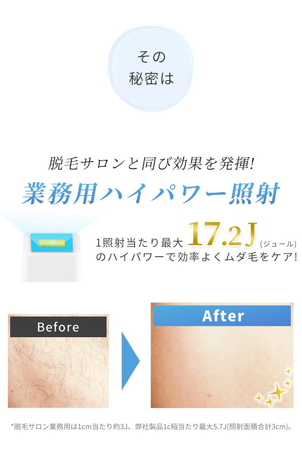 光脱毛機　ケノン　Ver.5.7 光脱毛機ケノンVer.5.7