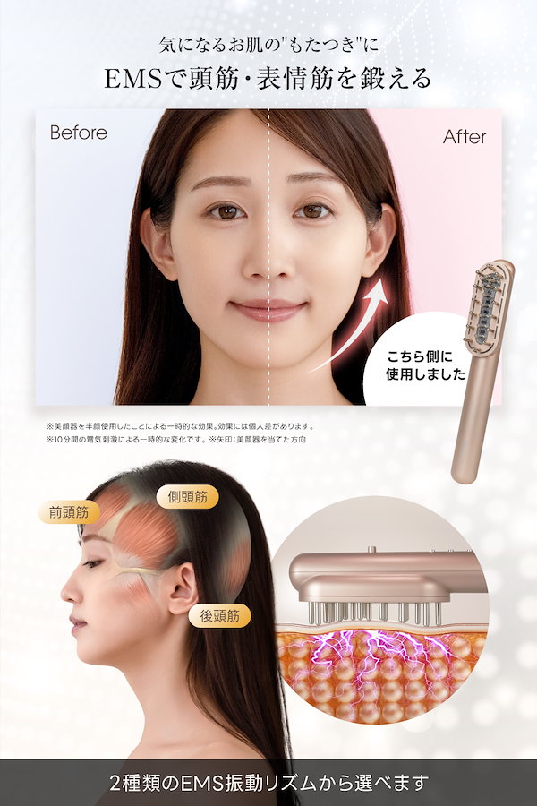 Qoo10] RELX EMS 電気ブラシ 美顔器【日本企業企画