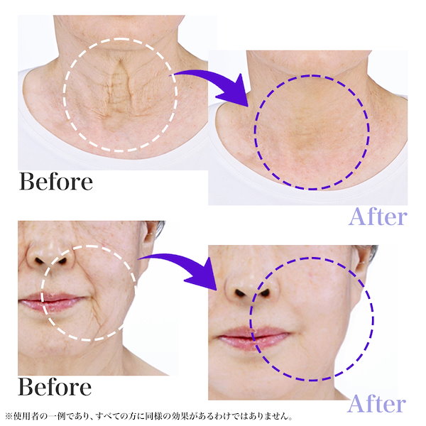 Qoo10] NINE TAILS 【公式】NINE TAILS（ナインテイ