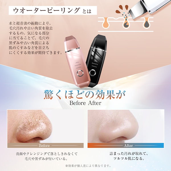 ウォーターピーリング 美顔器 ウォーターピーリング 美顔器 リフトアップ ウオーターピーラー 超音波