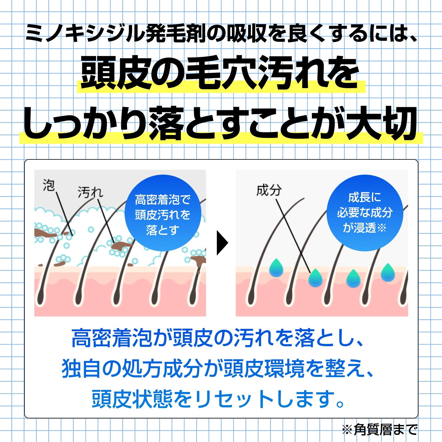 ヒックススカルプシャンプー 250mL 3本 ミノキシジル シャンプー 発毛シャンプー 発毛 シャンプー 育毛 ミノキ スカルプシャンプー アデノシン アミノ酸 メンズ 男性用 hx00200001 ヒックススカルプシャンプー 250mL 3本 ミノキシジル シャンプー 発毛シャンプー 発毛 シャンプー 育毛 ミノキ スカルプシャンプー アデノシン アミノ酸 メンズ 男性用 hx00200001