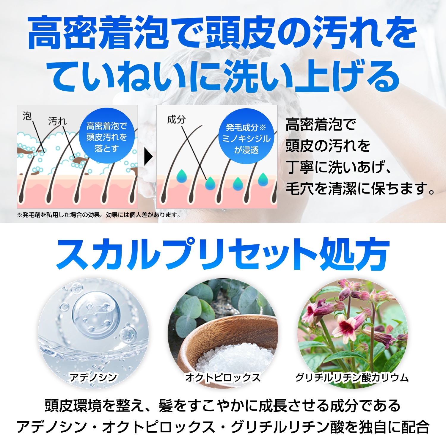 ヒックススカルプシャンプー 250mL 3本 ミノキシジル シャンプー 発毛シャンプー 発毛 シャンプー 育毛 ミノキ スカルプシャンプー アデノシン アミノ酸 メンズ 男性用 hx00200001 ヒックススカルプシャンプー 250mL 3本 ミノキシジル シャンプー 発毛シャンプー 発毛 シャンプー 育毛 ミノキ スカルプシャンプー アデノシン アミノ酸 メンズ 男性用 hx00200001