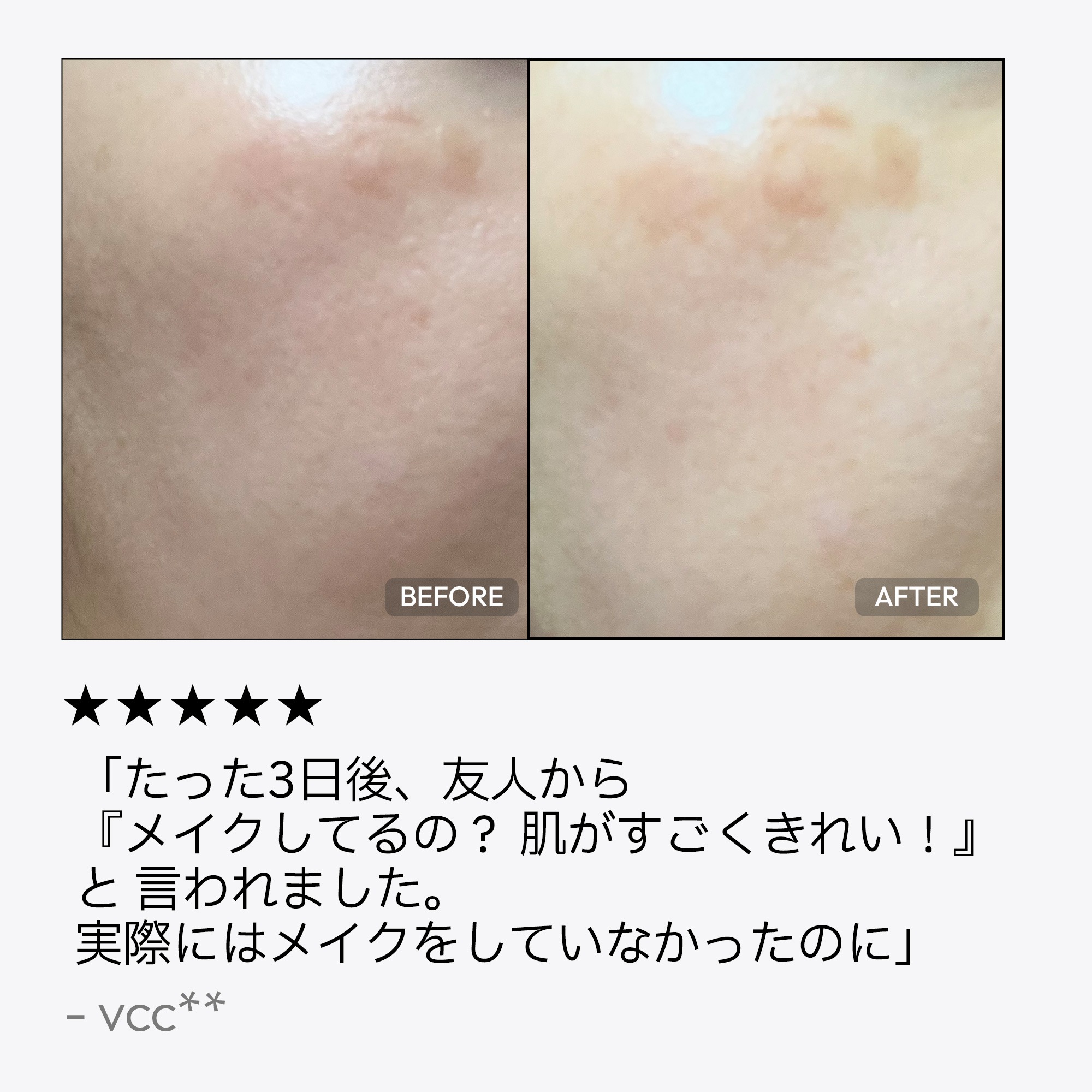 シミケアセラム 30ml シミケアセラム 30ml