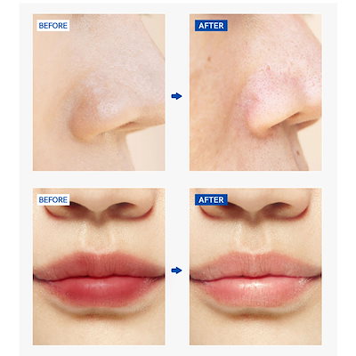 Qoo10] ドクターエステ [公式ショップ]Dr.estheモイスチ : スキンケア