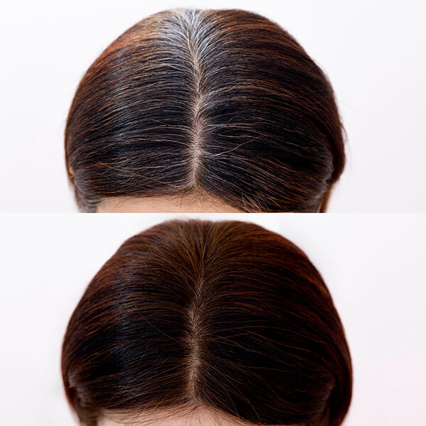 みんなでみらいを ヘナカラーセットダークブラウン30g2 5個セット みんなでみらいを ヘナカラーセットダークブラウン30g2 5個セット