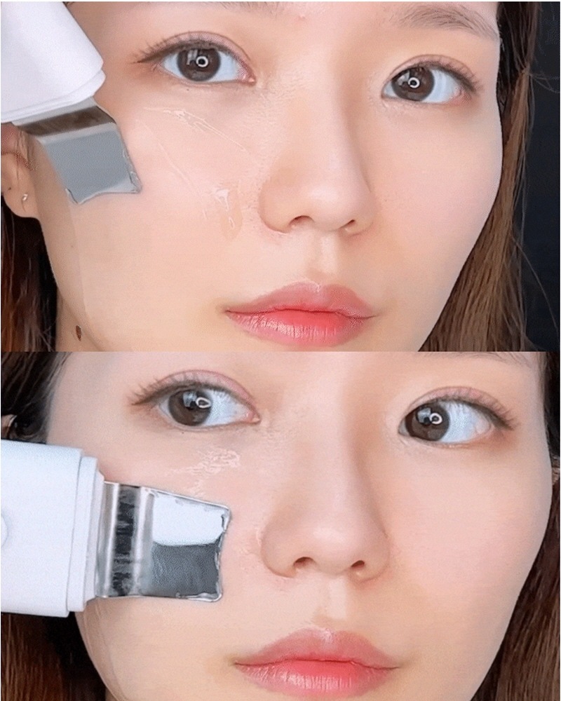 ガルバニック+ウォーターピーリング3in1ジェットピーリング機 ガルバニック+ウォーターピーリング3in1ジェットピーリング機