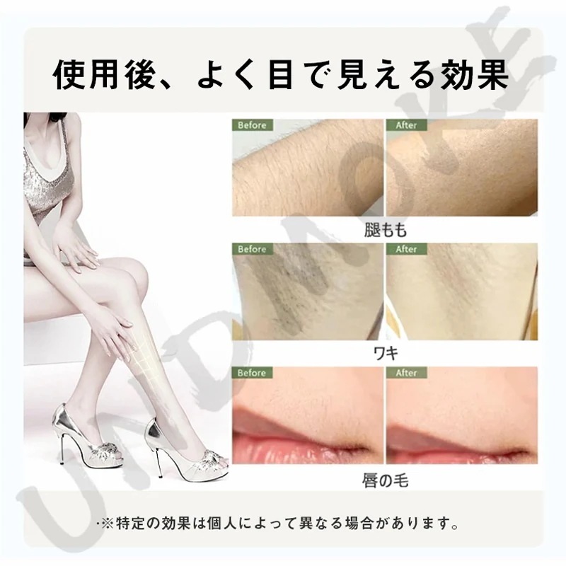 2025新品限定最新版 脱毛器 語説明書 99万発照射自動手動照射 9段階照射 全身兼用 家庭用脱毛器 2025新品限定最新版 脱毛器 語説明書 99万発照射自動手動照射 9段階照射 全身兼用 家庭用脱毛器