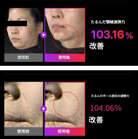 Qoo10] マミケアEMS V-Thera美顔器/中