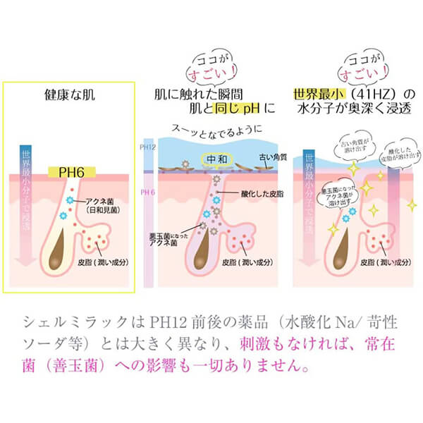 化粧水 ローション 拭き取り化粧水 シェルミラック スキンコンディショナー200ml 2本セット mdprevattcaulkingandwaterproofing.com