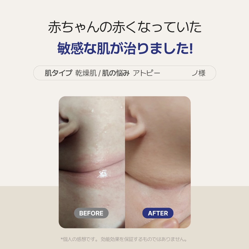 【公式ショップ】 ベビー基本セット【3点セット】(アートクリーム240ml / スージングジェル 200ml /バス&シャンプー 400ml)