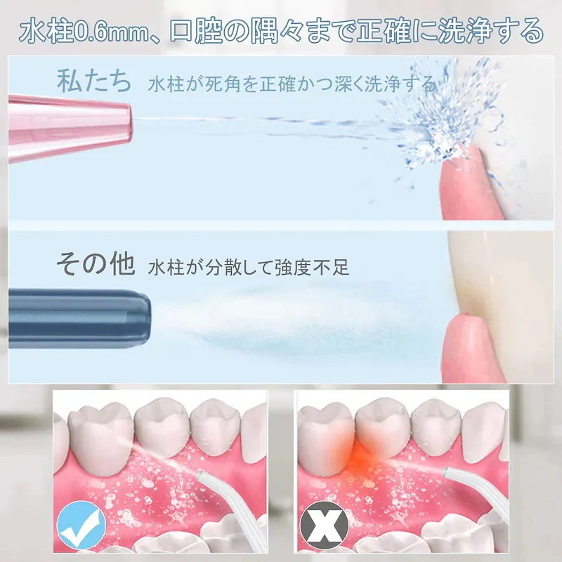 今だけ圧倒的販売 ジェットウォッシャー 口腔洗浄器 3種類モード調整 ウォーターフロス 防水 歯間洗浄 口腔洗浄機 洗浄 口臭 歯周ポケット ポータブル マウスウォッシャー ノズル4本