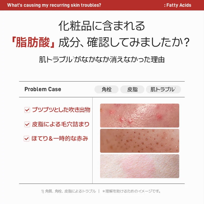 『27％限定クーポンあり』カン・ダニエルお得コラボ3点セット！　#ニキビ#毛穴#トラブル肌#皮脂バランス整える＃野バラの花水81％#皮脂バランス整える＃敏感肌でも使える