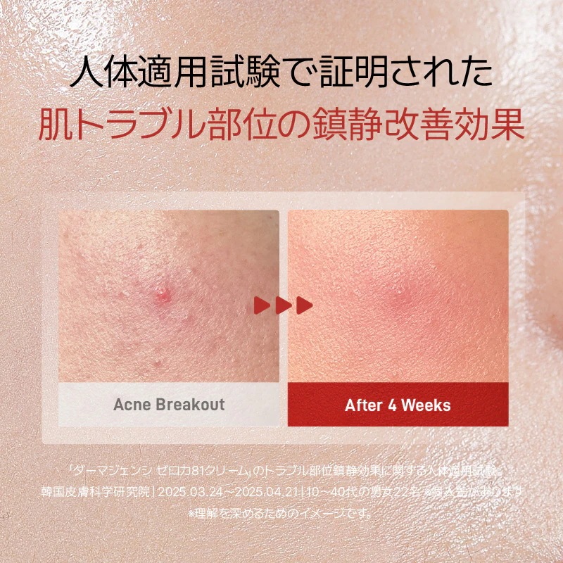 『27％限定クーポンあり』カン・ダニエルお得コラボ3点セット！　#ニキビ#毛穴#トラブル肌#皮脂バランス整える＃野バラの花水81％#皮脂バランス整える＃敏感肌でも使える